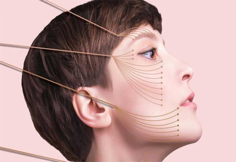 لیفت صورت با نخ در اصفهان چگونه انجام میشود؟